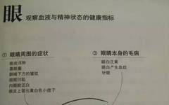 Essence of TCM Observation Diagnosis Illustrated