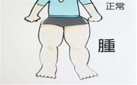 Manifestations of Kidney Yang Deficiency