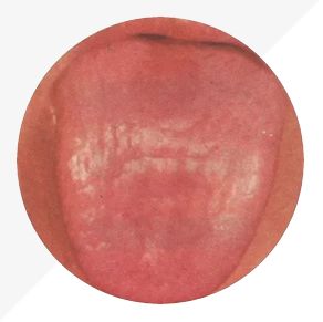 Understanding Tongue Diagnosis in TCM: Insights into Health from Tongue Appearance (Part 2)