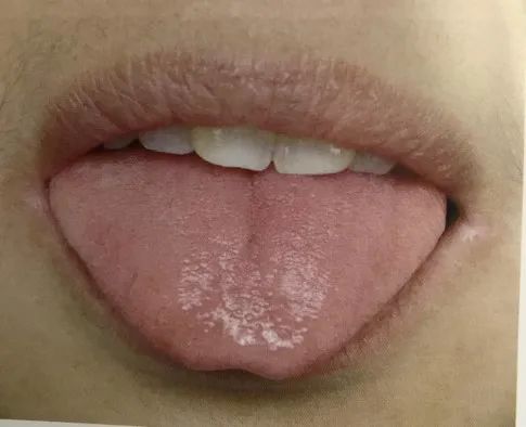 The Health Code Hidden on Your Tongue