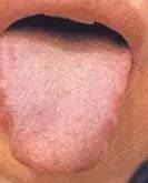 Comprehensive Guide to Tongue Diagnosis: Easily Understand Your Health Condition