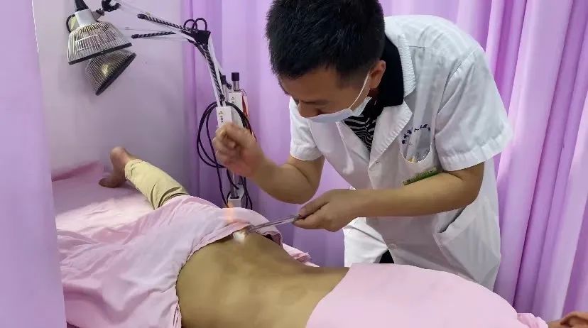 Fire Needle Therapy: A Unique Treatment in Traditional Chinese Medicine