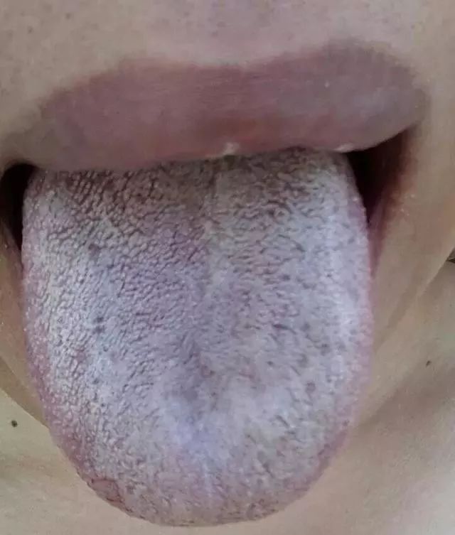 The TCM Tongue Diagnosis Atlas is Here! Observe the Tongue to Understand the Whole Body!