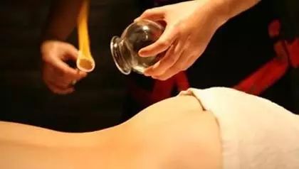 Understanding the Practice of Cupping Therapy