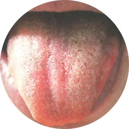High-Definition Color Atlas of Tongue Diagnosis: Over 100 Types, The Most Comprehensive Ever! (Recommended for Collection)
