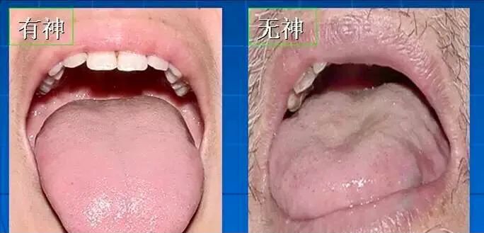 Tongue Diagnosis - Illustrated Guide to Tongue Manifestations
