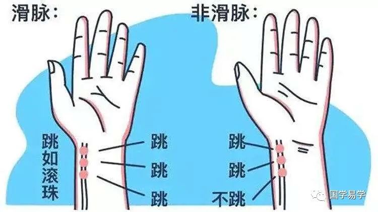 Self-Pulse Diagnosis: The Joyful Pulse