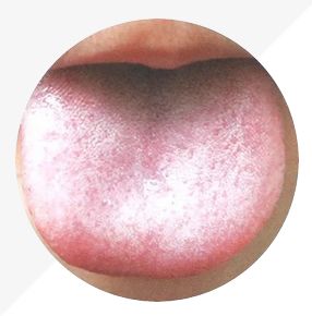 Understanding Tongue Diagnosis in TCM: Insights into Health from Tongue Appearance (Part 2)