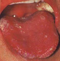 62 High-Definition Tongue Diagnosis Charts with Illustrations (Collector's Edition)