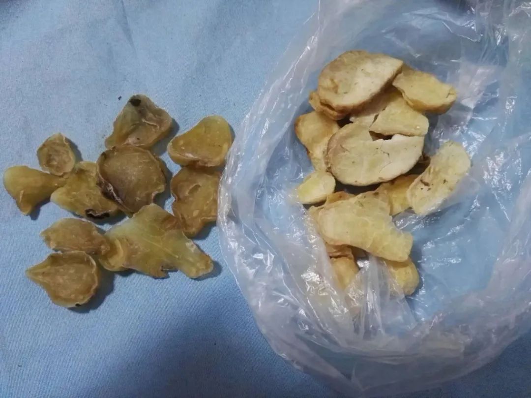 Spleen and Kidney Yang Deficiency: A Classic TCM Formula by Zhang Zhongjing