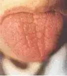 Comprehensive Guide to Tongue Diagnosis: Learn How Your Tongue Reflects Your Health!