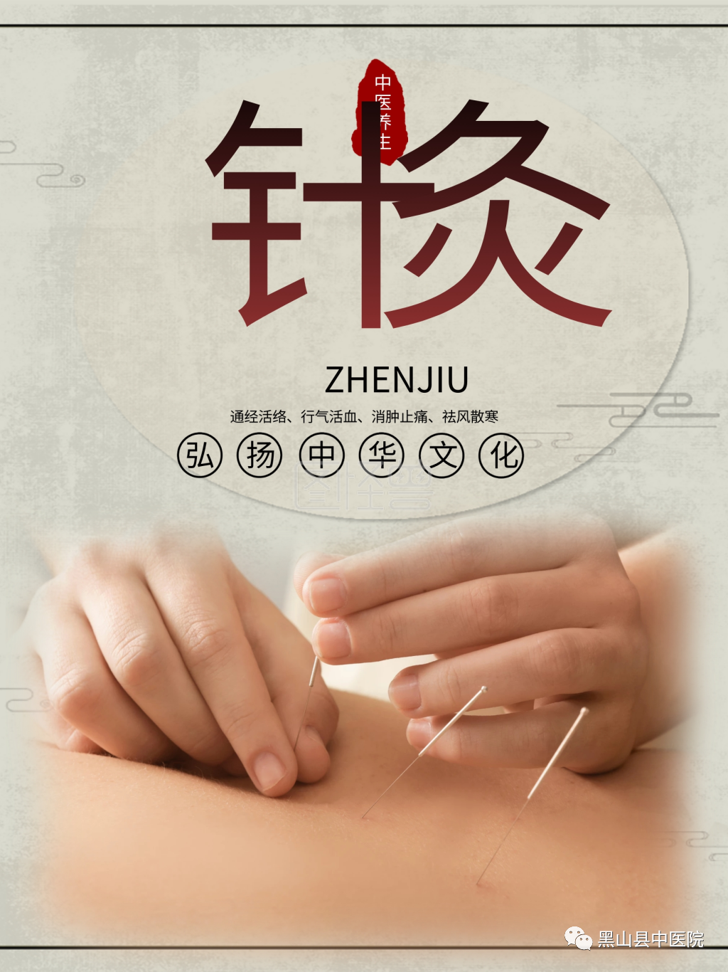 Traditional Chinese Medicine - Acupuncture