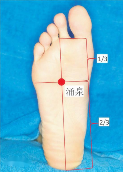 Traditional Chinese Medicine Treatment for Wind-Cold Headache