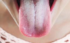 Traditional Chinese Medicine Tongue Diagnosis: What Different Tongue Appearances Indicate
