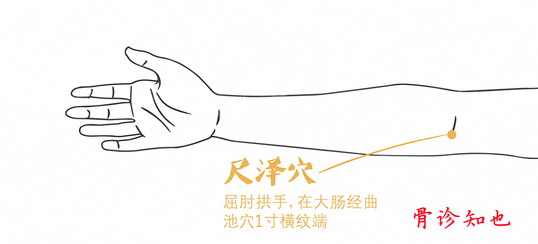 Bloodletting Therapy for 24 Difficult Diseases