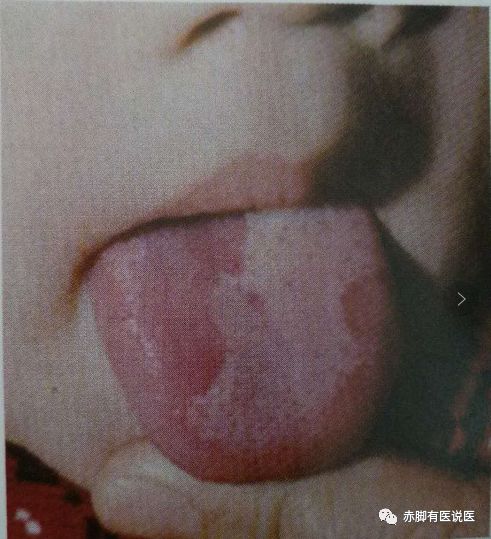 Understanding Your Tongue Diagnosis in 10 Minutes