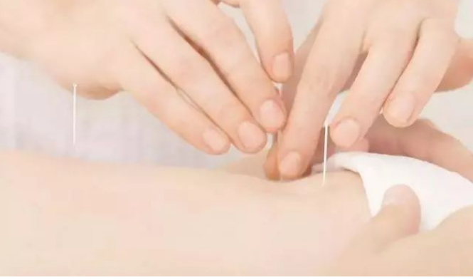 Balancing Yin and Yang in the Body: Preventing Disease and Treating Existing Conditions with Traditional Chinese Medicine Acupuncture