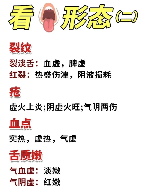 Analyzing Tongue Diagnosis: A Simple Approach to Understanding TCM