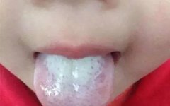 When Your Tongue Shows This Signal: Go to the Hospital Immediately, Don't Delay!