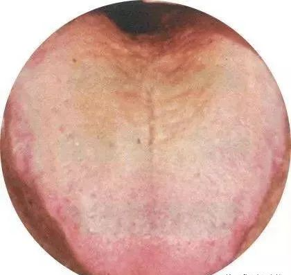 130 High-Definition Tongue Diagnosis Charts (Recommended for Collection)