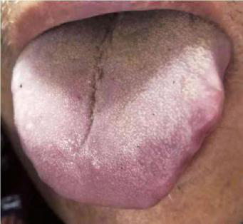 Understanding Health Through Tongue Observation: It's Not as Difficult as You Think