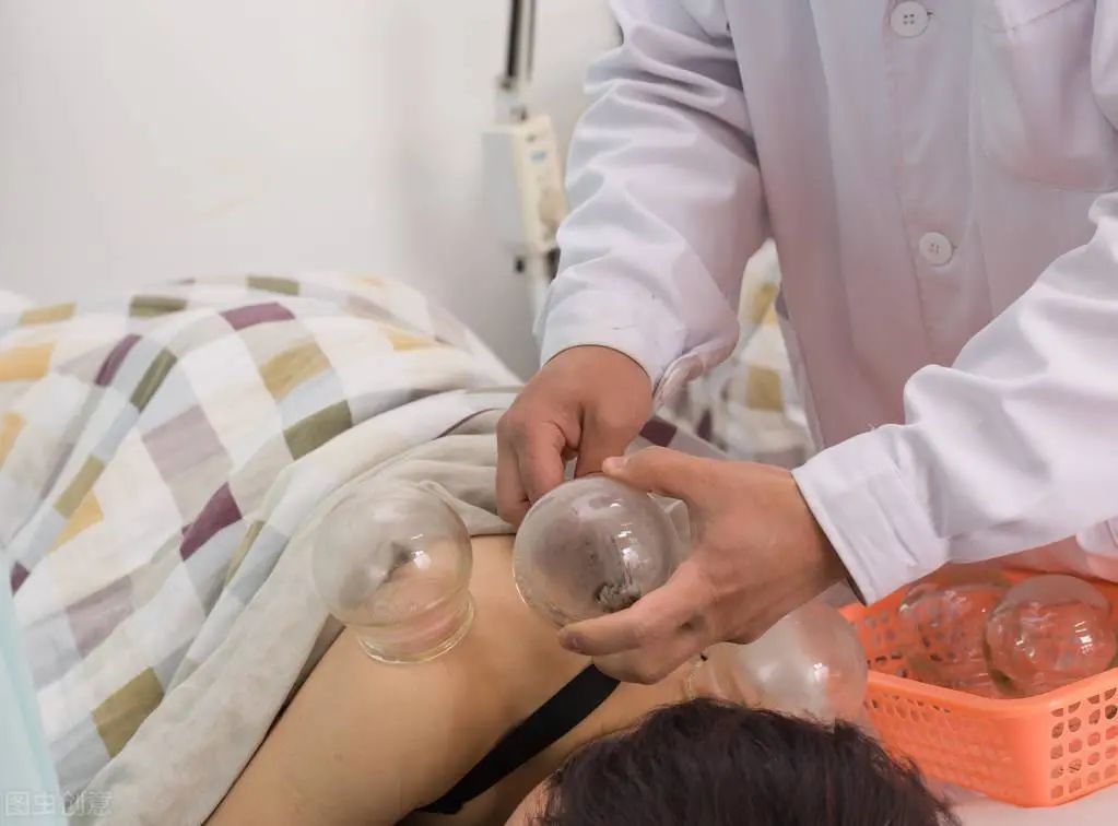 The Benefits of Cupping: Different Colors of Cupping Marks Reflect Various Health Conditions, Do You Know?