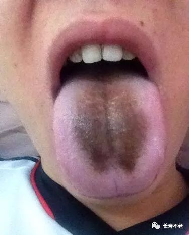 The Most Comprehensive TCM Tongue Diagnosis Atlas: Observe the Tongue, Understand the Whole Body!