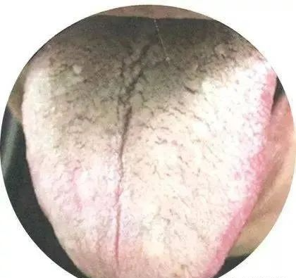 130 High-Definition Tongue Diagnosis Charts (Recommended for Collection)