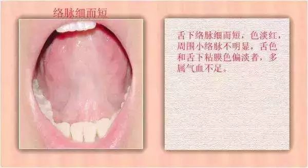 The TCM Tongue Diagnosis Atlas is Here! Observe the Tongue to Understand the Whole Body!