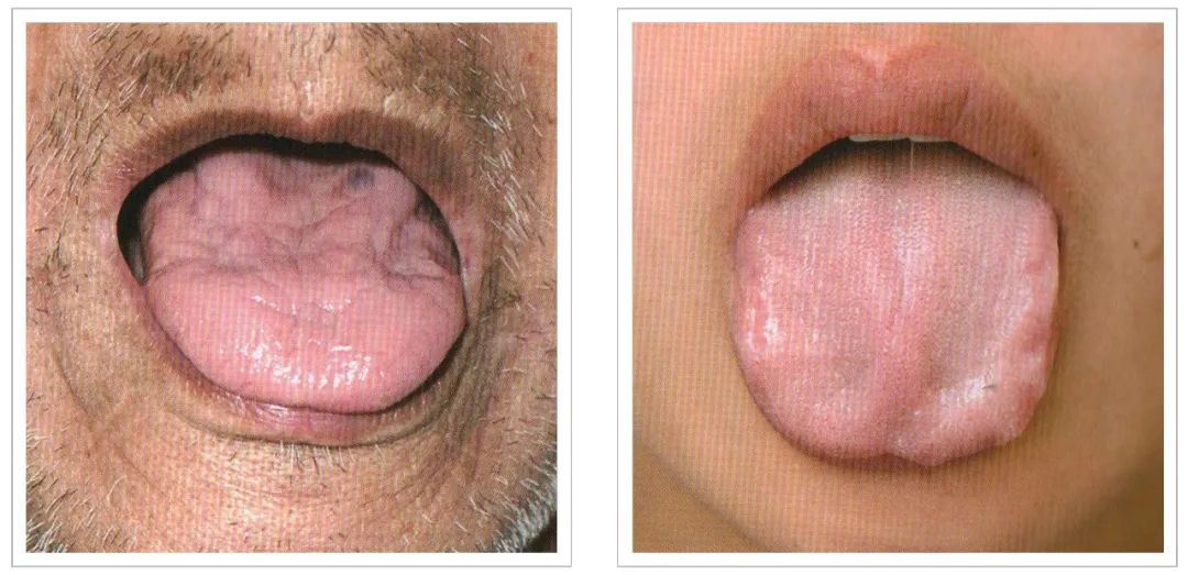 Analysis of Tongue Quality and Movement in Traditional Chinese Medicine
