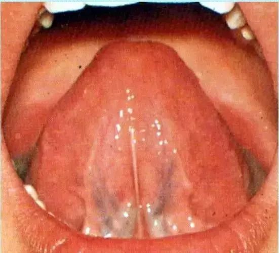 The Most Comprehensive Guide to Tongue Diagnosis! Master It and Become a Tongue Diagnosis Expert