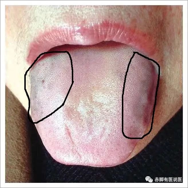 Understanding Your Tongue Diagnosis in 10 Minutes