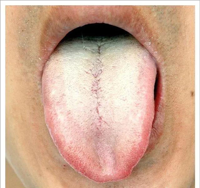 Traditional Chinese Medicine Tongue Diagnosis: 26 Clinical High-Definition Tongue Diagnosis Images with Analysis