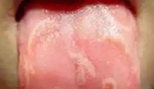 The Most Comprehensive Guide to Tongue Diagnosis! Master It and Become a Tongue Diagnosis Expert