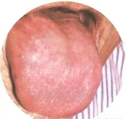130 High-Definition Tongue Diagnosis Charts (Recommended for Collection)