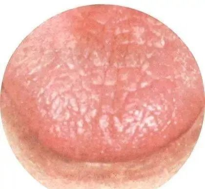 130 High-Definition Tongue Diagnosis Charts (Recommended for Collection)