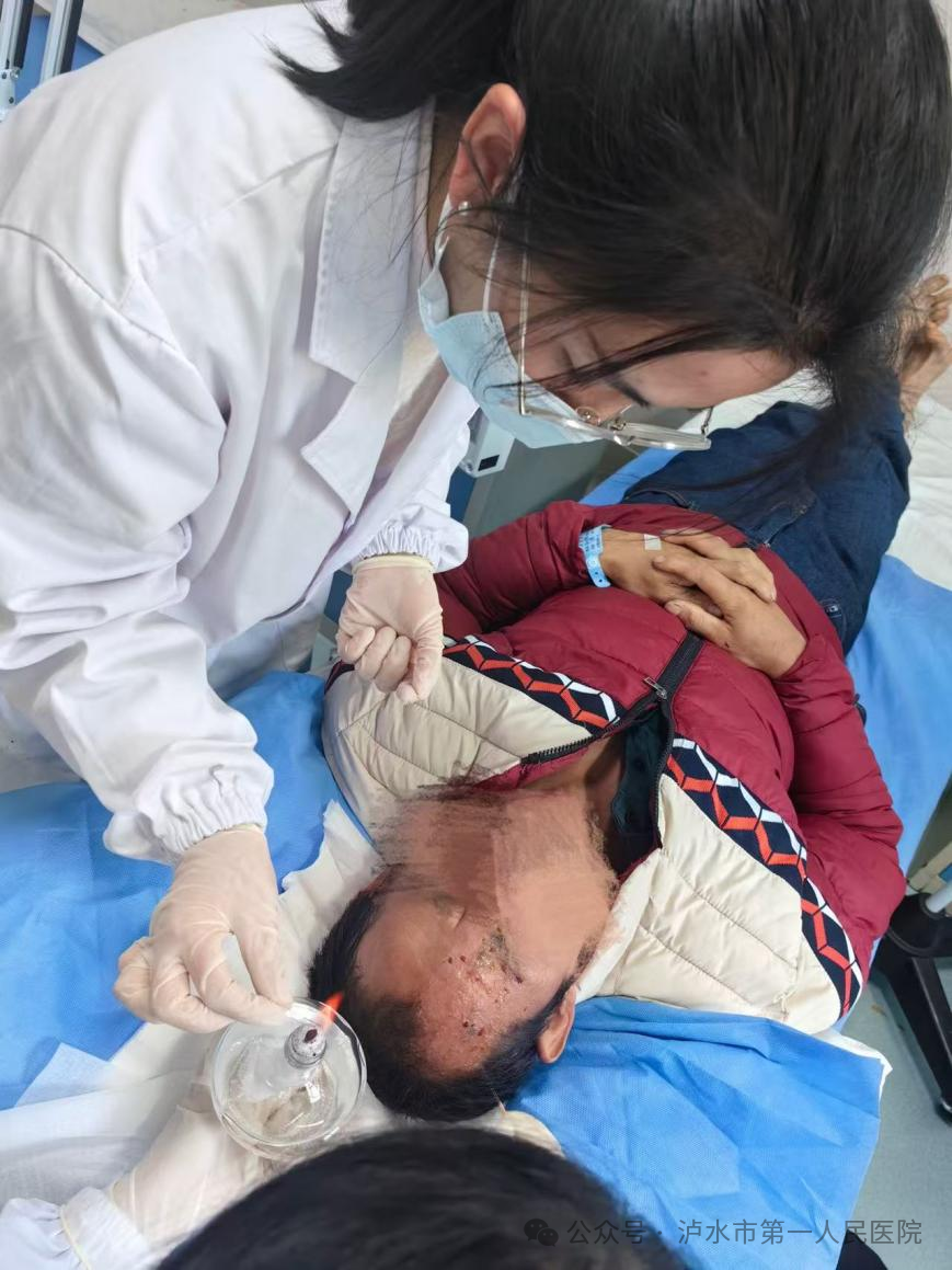 The Power of Small Needles: Lushui City First People's Hospital Implements Fire Needle and Bloodletting Cupping Therapy for Herpes Zoster
