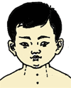 Pediatric Tuina Techniques to Help Manage Common Childhood Illnesses