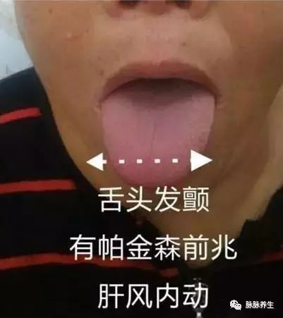 Tongue Diagnosis: A Clear Insight