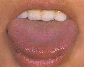 62 High-Definition Tongue Diagnosis Charts with Illustrations (Collector's Edition)