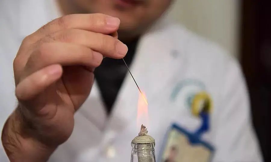 Traditional Chinese Medicine: Fire Needle Therapy