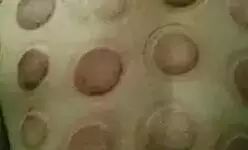 A Comprehensive Guide to Cupping Therapy