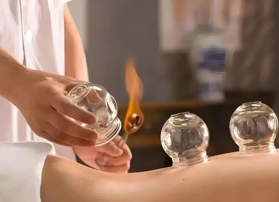 Traditional Chinese Medicine Techniques: Gua Sha and Cupping Therapy