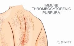 Symptoms of Blood Stasis and TCM Differentiation and Treatment