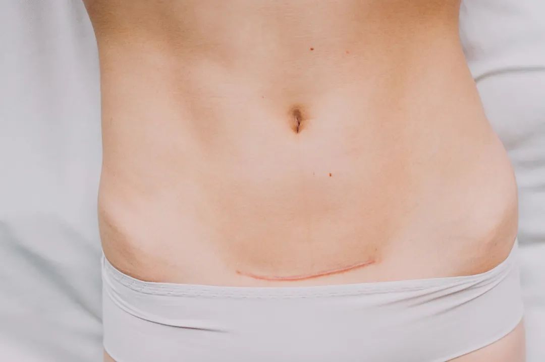 Traditional Chinese Medicine Insights: Improving Blood Stasis in Women