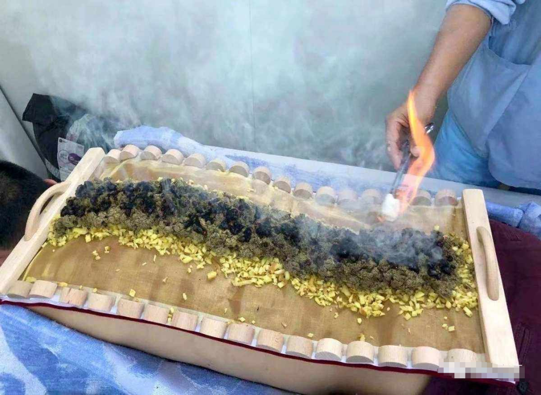 Warming Yang and Dispelling Cold: The First Moxibustion of Pain in Traditional Chinese Medicine