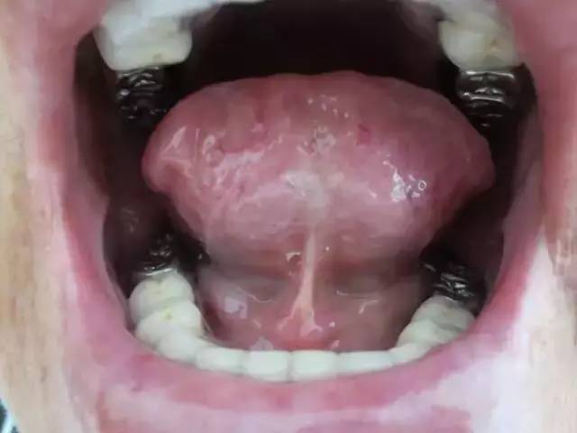 Exploring Tongue Diagnosis in Traditional Chinese Medicine: Hidden Insights and Tongue Diagnosis Atlas