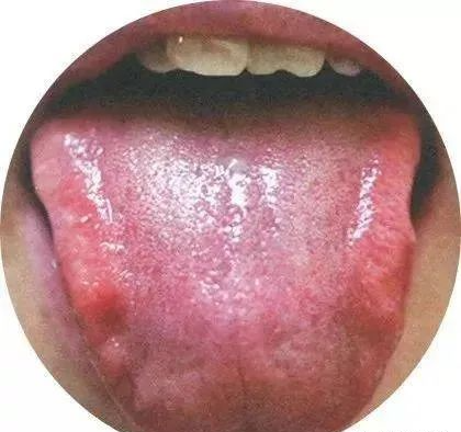 130 High-Definition Tongue Diagnosis Charts (Recommended for Collection)