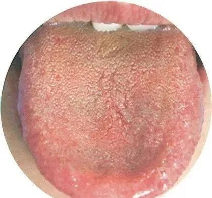 130 High-Definition Tongue Diagnosis Charts (Recommended for Collection)