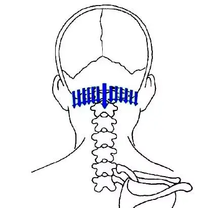 Comprehensive Gua Sha Therapy for Different Types of Colds in Traditional Chinese Medicine
